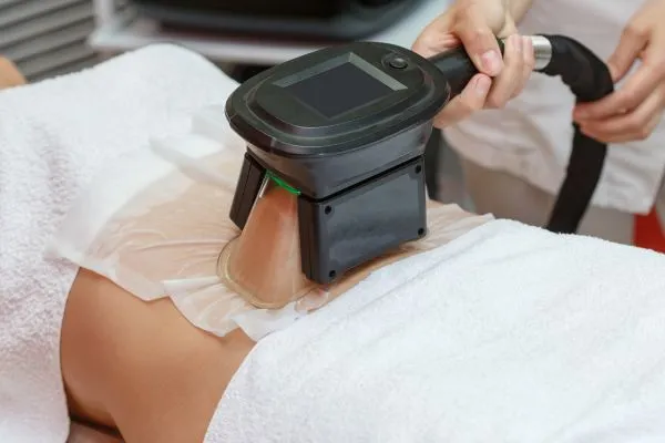 Image of person having fat freezing treatment to help weight gain Tonbridge