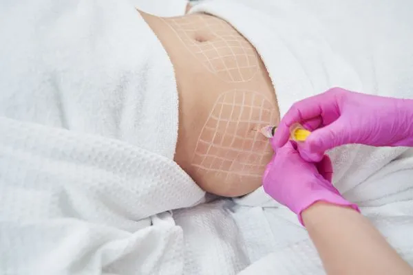 image of fat dissolving injections on love handles to help combat weight gain Tonbridge
