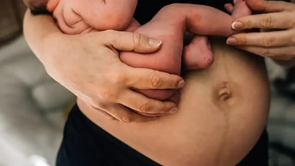 Why Is My Stomach Still Big After Pregnancy Tonbridge?